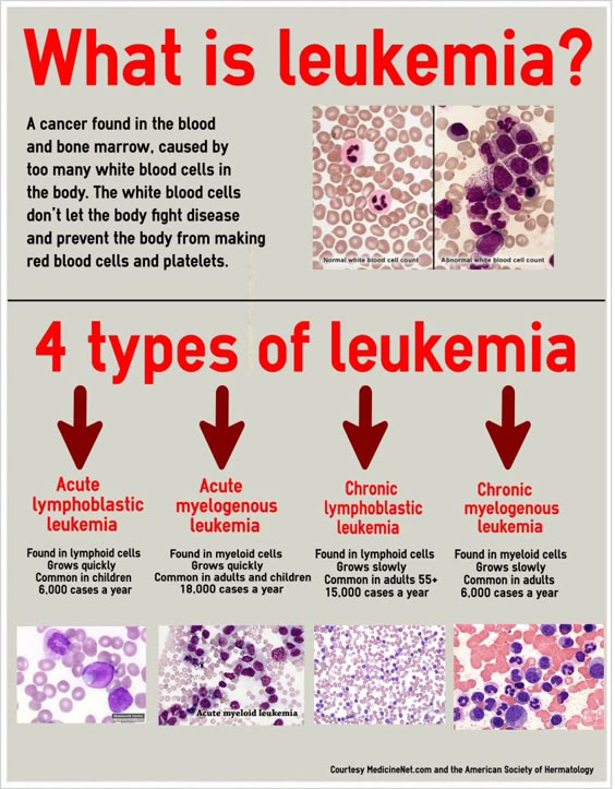 bruise age dating chart